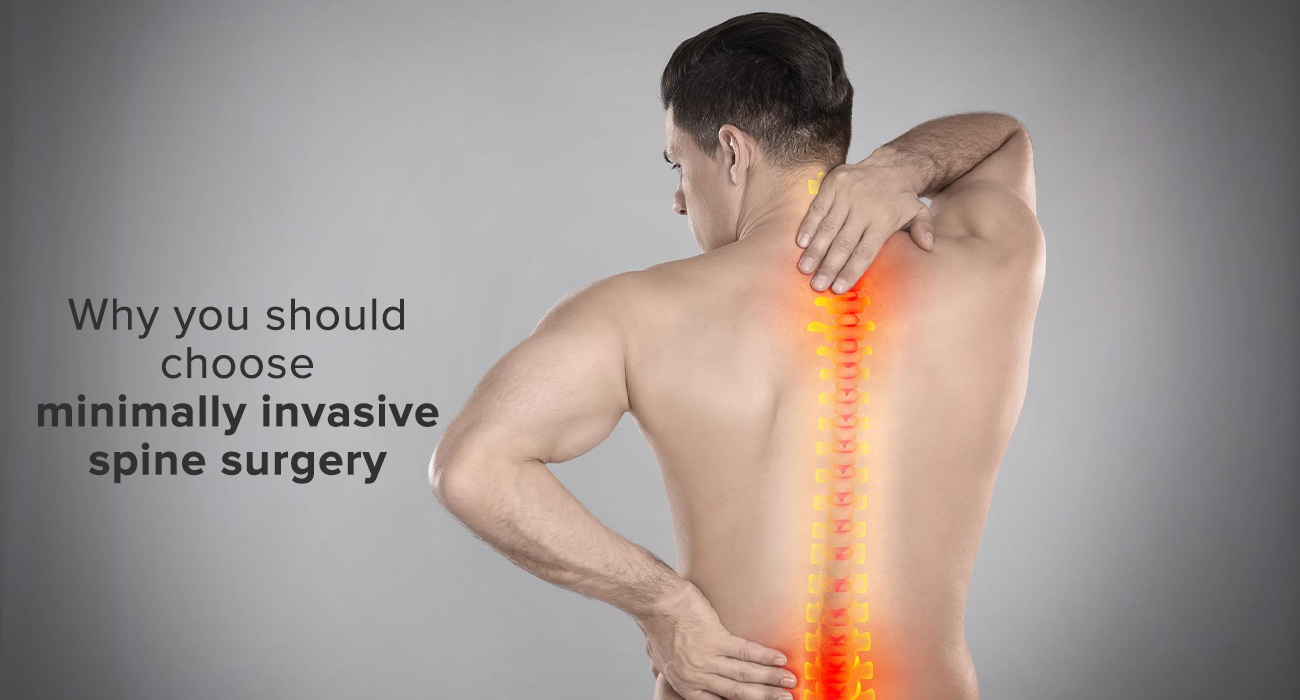 Why Should You Choose Minimally Invasive Spine Surgery?